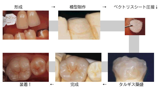 ����菇�i�P���j